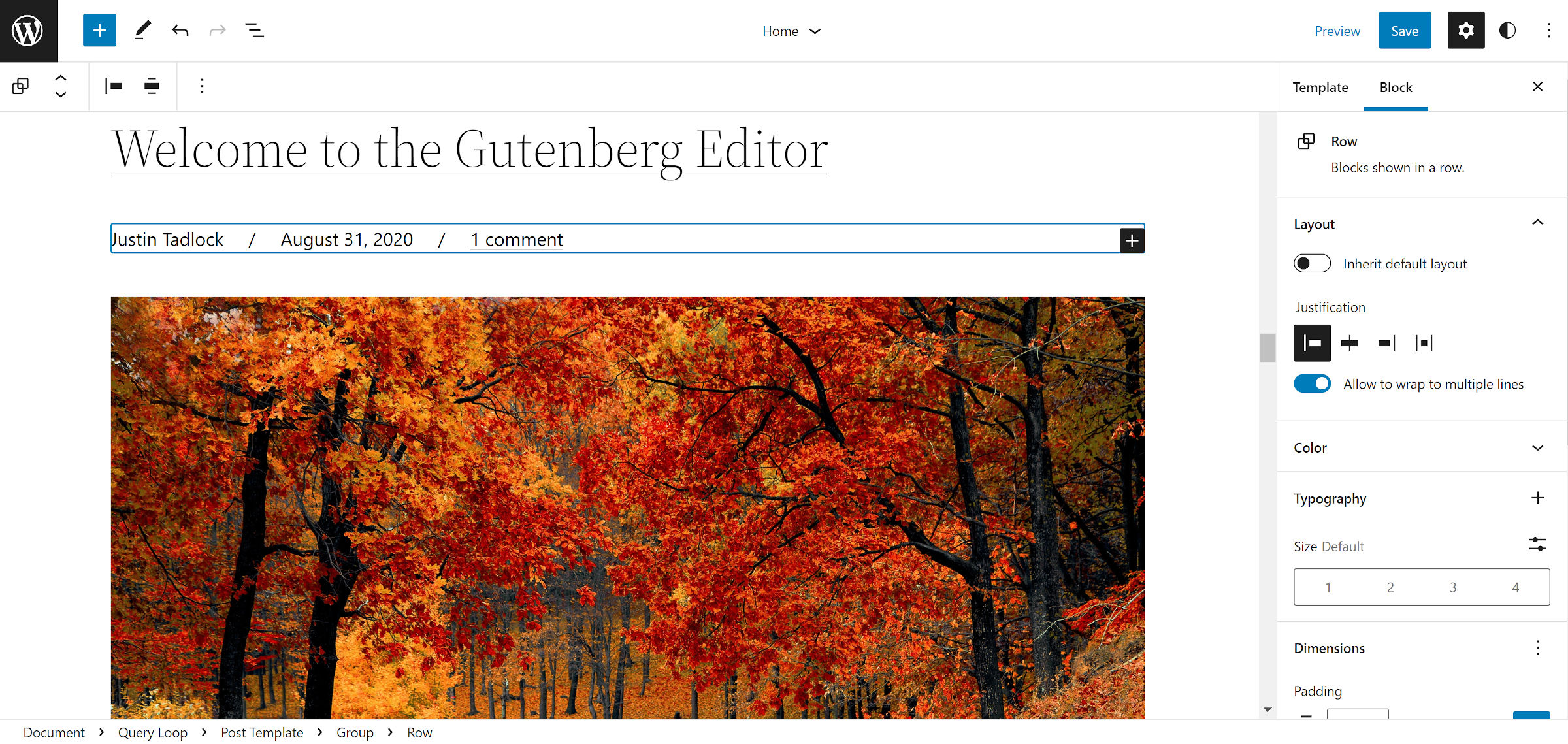 Inserting a custom byline area in the Query Loop block in the WordPress site editor. Below the post title, appears the author name, date, and comments link.